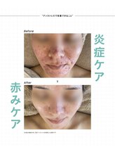 ミレラ(Mirela)/ダメージ肌を潤い満たされる肌へ