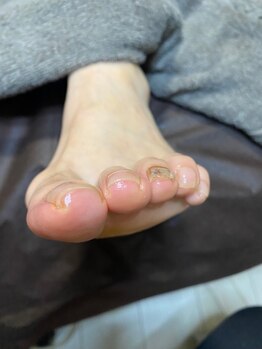 ドイツ式ケアでお悩み解決after