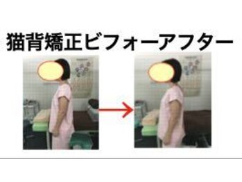 やち鍼灸院/猫背矯正で姿勢美人に！