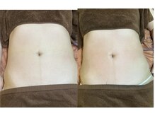 ドクタースタイル(Dr.style)/お腹も内側からスッキリ