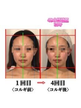 小顔整体研究所 KSラボ 新潟中山店/