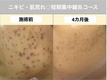 トーリ 代官山(taulli)の雰囲気（ニキビケア・髪のお悩みビフォアアフターはフォトギャラリーへ！）