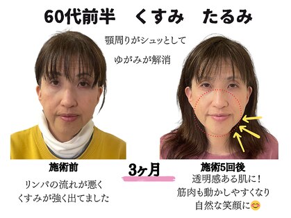 ラ キュート(LA-9TE)の写真