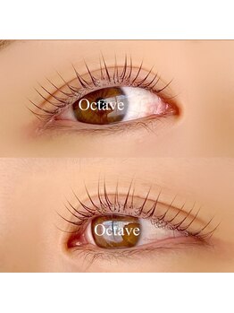 まつげのお悩み解決サロン