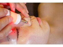 アンジェロ/【ニキビケア】肌育プログラム