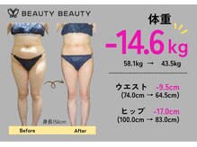 ビューティービューティー 大垣店の雰囲気（体質や肉質に合わせた最適な痩身プランをご提案いたします◎）