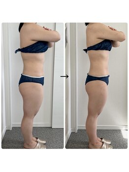 グレース(Grace luxe)/全身－38cm減！楽～に7ｋｇ減☆