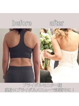 ベルフォルム(Belle Forme)/痩身×ブライダルの最強メニュー