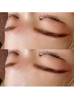 シュカ(Shuka)/ハリウッドブロウリフト