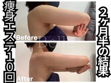 ベル 南船場店(Belle)/ブライダルの方も◎