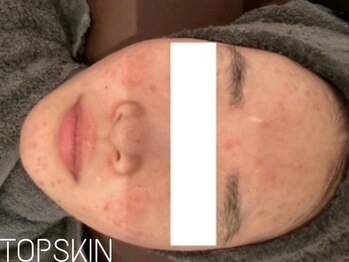 トップスキン 栄(TOPSKIN)/深いお肌悩みも内側から徹底改善