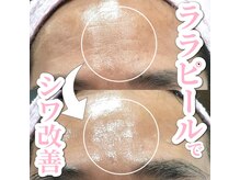 サロン(SALON)/ララピール+LDM