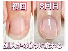 スターネイル(Starnail)