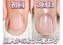 スターネイル(Starnail)