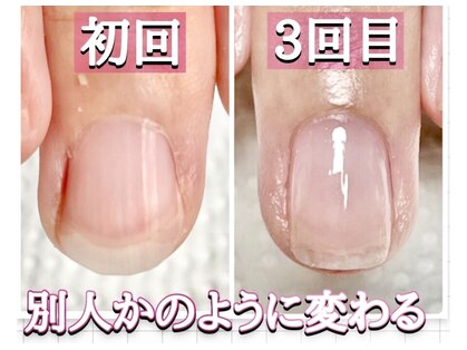 スターネイル(Starnail)の写真