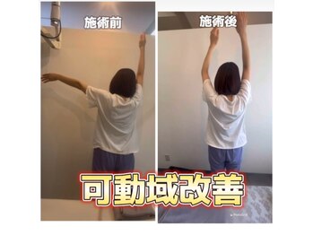 鍼灸整骨院ナガサキ(nagasaki)/神経整体