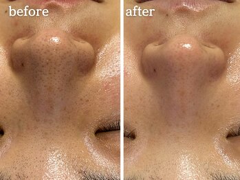 メルシア(merucia)/