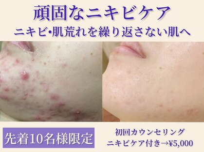 エピア 三河安城店(Epia)の写真