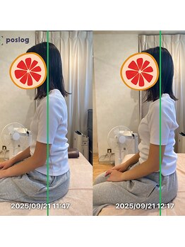 グレフル鍼灸接骨院 整体院 心斎橋/整体/肩こり/マッサージ/腰痛