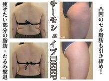 スパイア(SPIRE)の雰囲気（サーモシェイプDEEPで脂肪撃退・たるみケアにも◎痩身/小顔）