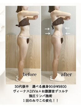 モア 恵比寿(MORE.)/即効性!たった1回でも効果実感