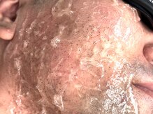 メロウ(mellow)の雰囲気（ハイパワー脱毛機導入☆施術直後から飛び出る毛☆）