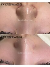 ユンプラス(yun+)/【Before/After】