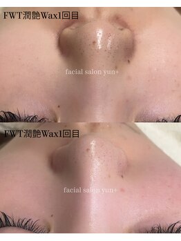 ユンプラス(yun+)/【Before/After】