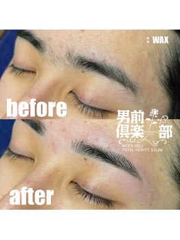 男前倶楽部/脱毛/メンズ脱毛/メンズ専門店