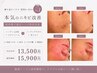 【本気のニキビ改善】肌状態で選ぶハーブ◇LDMエクソソーム/プラズマ光フォト