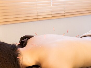 ハンドマイルド 赤坂 六本木(Hand Mild)/癒しの鍼灸