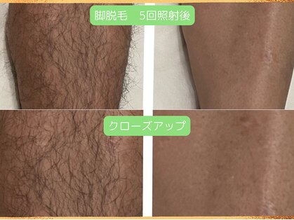 リヒト(LiHiTO)の写真