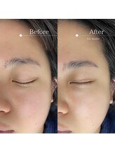 カラー(CALLA)/ハリウッドブロウリフト