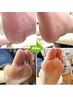 【ガサガサかかと・硬くなった角質に】足裏角質しっかりケア　￥8800→￥8000