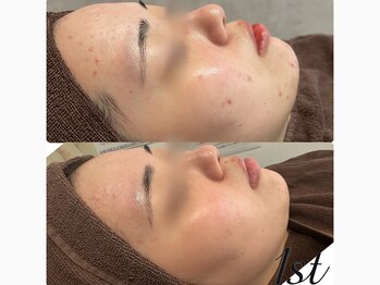 ファースト(1st)/