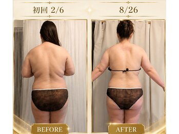 ポノ(pono)/beforeafter