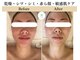 ミューズ 成城(MUSE)の写真/【毛穴・小顔・シミ・乾燥・カサつき・くすみ・色ムラ】小じわを改善フェイシャルエステ+ヘッド付き