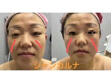 シャン カルナの雰囲気（大人気！！年齢による老化ケア、一回で実感、即効性）