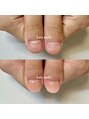 アーティネイルズ(Aaty Nails)&nbsp;1回目から見た目改善が叶います。一緒に綺麗を目指しましょう☆