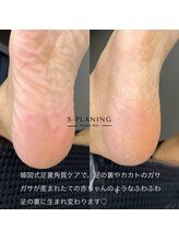 サロン ド ネイル 椿(Salon de nail 椿)/乾燥する季節に