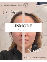 ココセンガビューティークリニック 恵比寿(COCO SENGA Beauty-Clinic)/【インモード】before/after