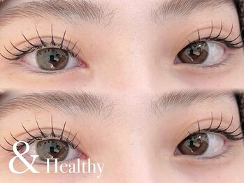 ネオリーブ ウリ(Neolive uri)の写真/マツエク×まつげパーマの良いとこどり【＆Healthy/アンドヘルシー】自まつ毛が濃く伸びたような仕上がりに