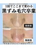 【人気No.1】気になる鼻の黒ずみ/毛穴洗浄/毛穴エクストラクションプロ80分