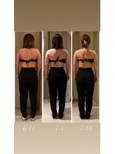 ドゥ ボーテ(de beaute)/30代、背中のはみ肉撃退！