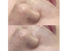 ハイク バイ ジェン 太田店(HIKE by gen.)/フェイシャルワックス