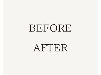 ソウェル(soweru.)/before / after