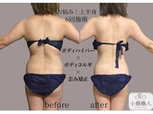 小顔職人/ボディビフォーアフター/40代