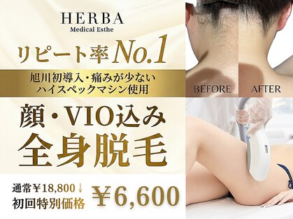 ヘルバ(HERBA)の写真