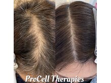 リバージュサロン(RIVAGE salon)の雰囲気(【あなたの頭皮は大丈夫?】隙間のある分け目を卒業!)