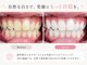 ココホワイトニング(coco whitening)の写真